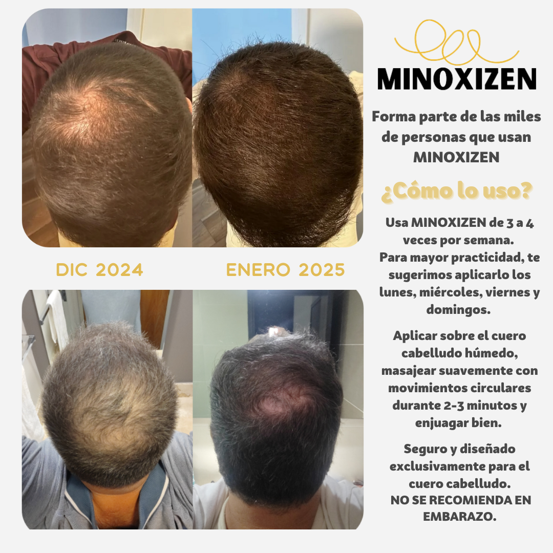 Minoxizen - Shampoo con Minoxidil, Biotina & Bergamota 2x1