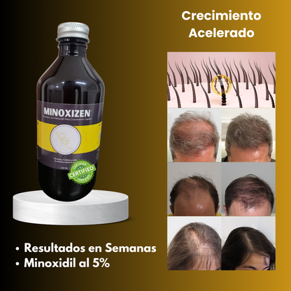 Minoxizen - Shampoo con Minoxidil, Biotina & Bergamota