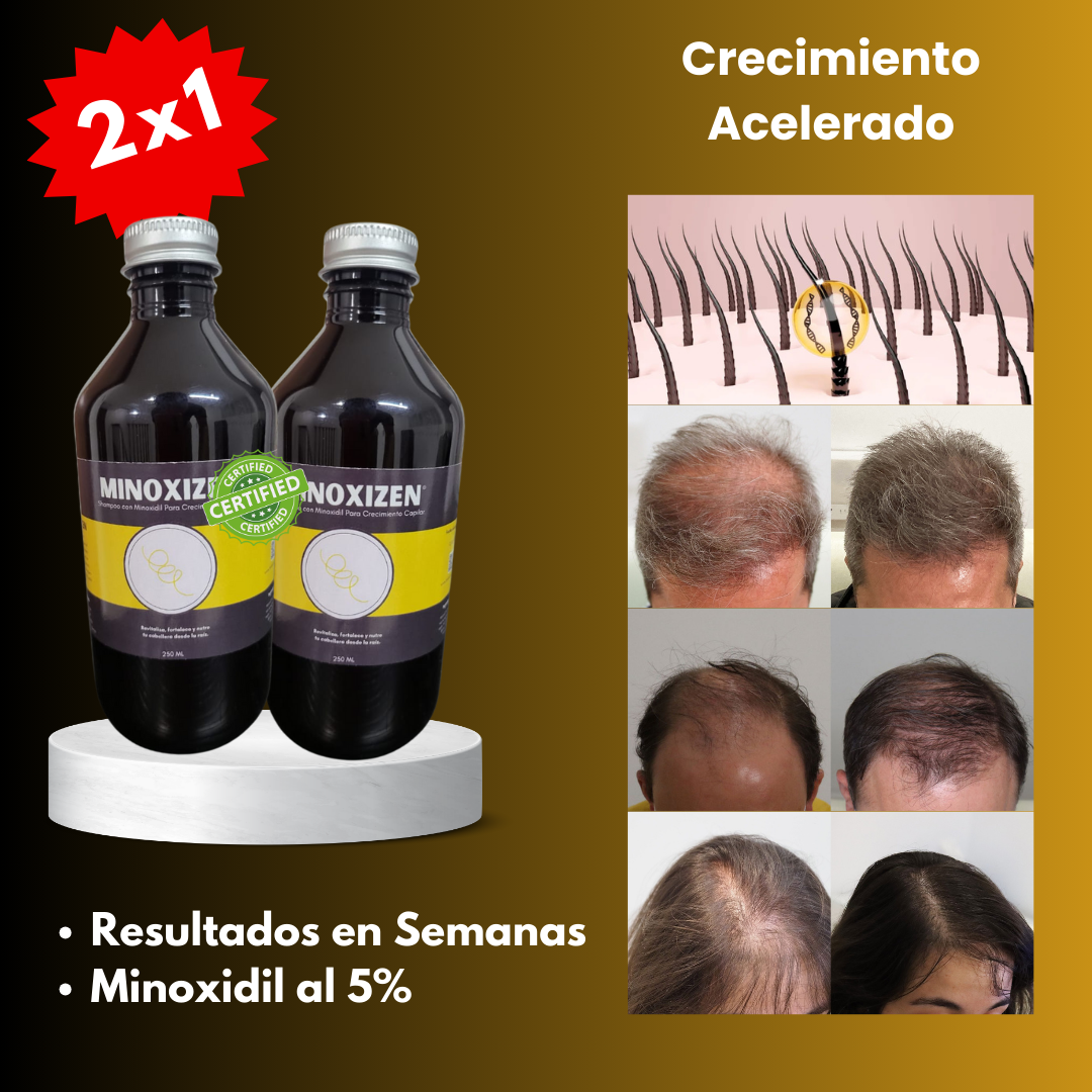 Minoxizen - Shampoo con Minoxidil, Biotina & Bergamota 2x1