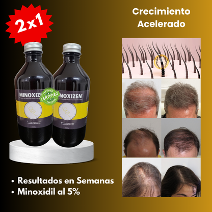 Minoxizen - Shampoo con Minoxidil, Biotina & Bergamota 2x1